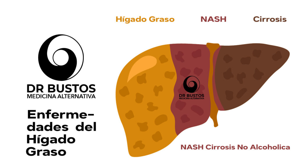 higado graso colesterol trigliceridos altos quelacion limpieza arterial barrido arterial tratamiento higado graso bogota higado graso bogota higado bueno